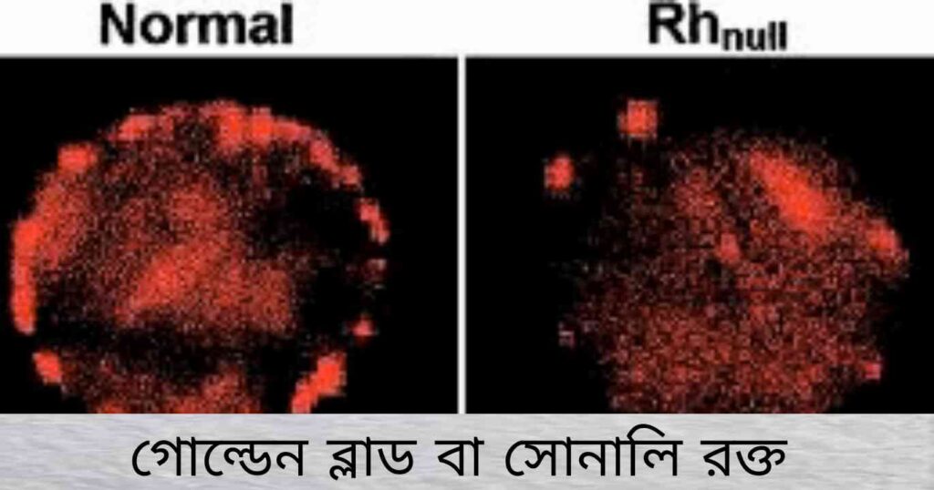 Golden Blood বা সোনালি রক্ত - রক্তবন্ধু